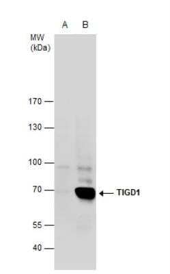 Western Blot: TIGD1 Antibody [NBP2-20640] - A. 30 ug 293T whole cell extract B. 30 ug whole cell extract of human TIGD1-transfected 293T cells 7.5 % SDS-PAGE TIGD1 antibody dilution: 1:5000