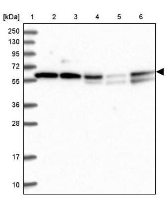 Western Blot: TIGD1 Antibody [NBP2-47606] - Lane 1: Marker  [kDa] 250, 130, 95, 72, 55, 36, 28, 17, 10.  Lane 2: Human cell line RT-4.  Lane 3: Human cell line U-251MG.  Lane 4: Human plasma (IgG/HSA depleted).  Lane 5: Human liver tissue.  Lane 6: Human tonsil tissue.