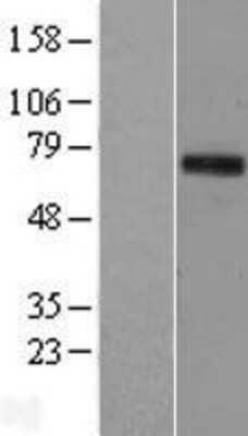 Western Blot: TIGD1 Overexpression Lysate (Adult Normal) [NBL1-16911] Left-Empty vector transfected control cell lysate (HEK293 cell lysate); Right -Over-expression Lysate for TIGD1.