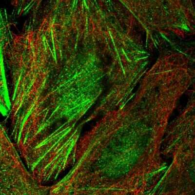 Immunocytochemistry/Immunofluorescence: TIGD6 Antibody [NBP1-92508] - Immunofluorescent staining of human cell line U-2 OS shows localization to nucleoplasm & actin filaments.