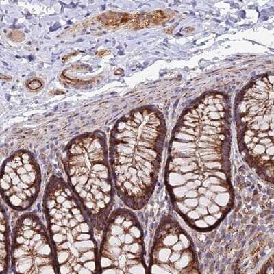 Immunohistochemistry-Paraffin: TIGD6 Antibody [NBP1-92508] - Staining of human colon shows strong cytoplasmic positivity in glandular cells, endothelial cells and ganglion cells.