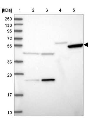 Western Blot: TIGD6 Antibody [NBP1-92508] - Lane 1: Marker [kDa] 250, 130, 95, 72, 55, 36, 28, 17, 10Lane 2: Human cell line RT-4Lane 3: Human cell line U-251MG spLane 4: Human plasma (IgG/HSA depleted)Lane 5: Human liver tissue