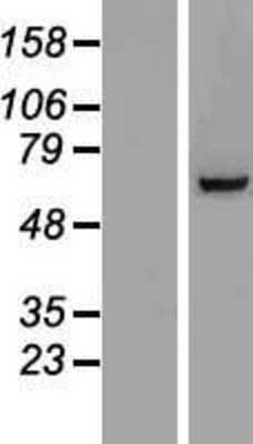 Western Blot: TIGD6 Overexpression Lysate (Adult Normal) [NBP2-06149] Left-Empty vector transfected control cell lysate (HEK293 cell lysate); Right -Over-expression Lysate for TIGD6.