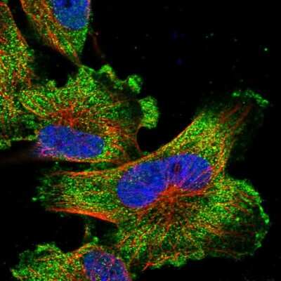 Immunocytochemistry/ Immunofluorescence TIGD7 Antibody