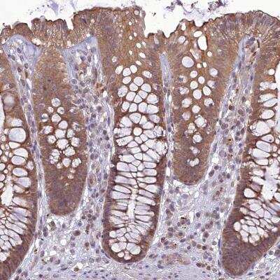 Immunohistochemistry TIGD7 Antibody