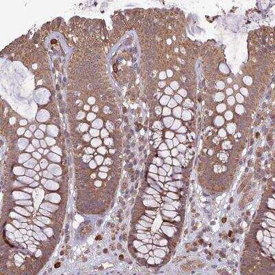 Immunohistochemistry: TIGD7 Antibody [NBP1-80791] - Staining of human colon shows moderate cytoplasmic positivity in glandular cells.