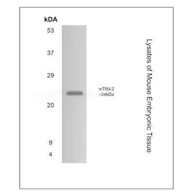 Western Blot: TIM-2 Antibody (RM0134-5B23) - Azide and BSA Free [NBP1-22510] - Lysates of Mouse Embryonic Tissue with Rat Monoclonal anti-Mouse TIM-2. 