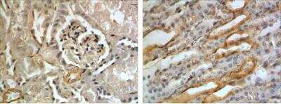 Immunohistochemistry-Paraffin: TIM-2 Antibody (RM0134-5B23) - Azide and BSA Free [NBP1-22510] - TIM-2 Antibody (RM0134-5B23)