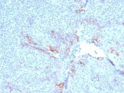 Immunohistochemistry-Paraffin: TIM-3 Antibody (TIM3/3113) - Azide and BSA Free [NBP2-79836] - Formalin-fixed, paraffin-embedded human Tonsil stained with TIM-3 Antibody (TIM3/3113).