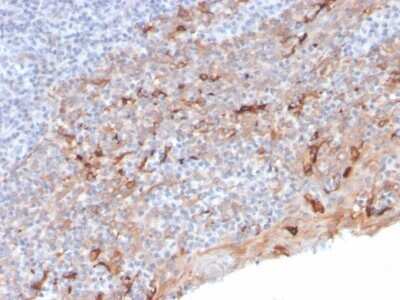Immunohistochemistry-Paraffin: TIM-3 Antibody (TIM3/3113) - Azide and BSA Free [NBP2-79836] - Formalin-fixed, paraffin-embedded human Tonsil stained with TIM-3 Antibody (TIM3/3113).