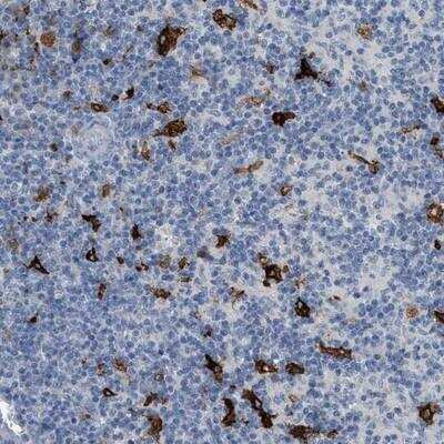 Immunohistochemistry-Paraffin: TIM-4 Antibody [NBP1-87569] - Staining of human lymph node shows distinct positivity in macrophages.