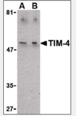 Western Blot: TIM-4 Antibody [NBP1-03238] - TIM-4 in Jurkat lysate with TIM-4 antibody at (A) 1 and (B) 2 ug/ml.