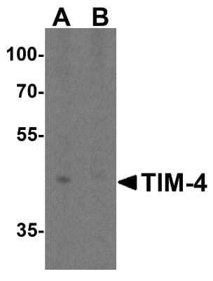 Western Blot: TIM-4 Antibody [NBP1-76702] - Analysis of TIM-4 in RAW264.7 cell lysate with TIM-4 antibody at 2 ug/mL in (A) the absence and (B) the presence of blocking peptide.