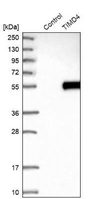 Western Blot: TIM-4 Antibody [NBP1-87569] - Analysis in control (vector only transfected HEK293T lysate) and TIMD4 over-expression lysate (Co-expressed with a C-terminal myc-DDK tag (3.1 kDa) in mammalian HEK293T cells).