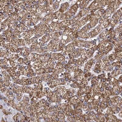 Immunohistochemistry-Paraffin: TIMM10 Antibody [NBP1-80682] - Staining of human liver shows moderate to strong granular cytoplasmic positivity in hepatocytes.