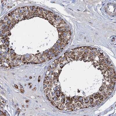 Immunohistochemistry-Paraffin: TIMM10 Antibody [NBP1-80682] - Staining of human testis shows strong granular cytoplasmic positivity.