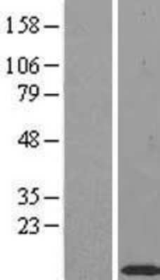 Western Blot: TIMM10 Overexpression Lysate (Adult Normal) [NBL1-16916] Left-Empty vector transfected control cell lysate (HEK293 cell lysate); Right -Over-expression Lysate for TIMM10.