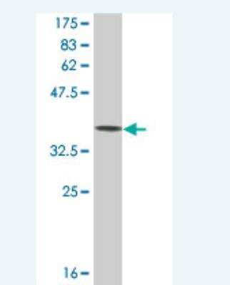 Western Blot: TIMM13 Antibody (4F4) [H00026517-M03A] - Detection against Immunogen (36.19 KDa) .