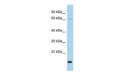 Western Blot: TIMM23 Antibody [NBP2-83652] - WB Suggested Anti-TIMM23B Antibody. Titration: 1.0 ug/ml. Positive Control: Fetal Brain