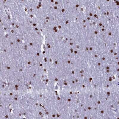 Immunohistochemistry-Paraffin: TIMM29 Antibody [NBP1-94151] - Staining of human cerebral cortex shows strong nuclear positivity in glial cells.