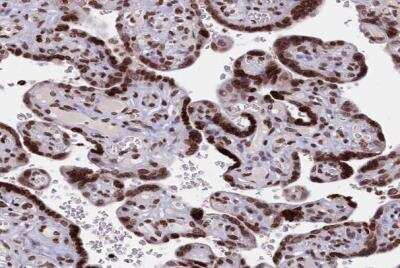 Immunohistochemistry-Paraffin: TIMM29 Antibody [NBP1-94151] - Staining of human placenta shows strong nuclear positivity in trophloblastic cells.