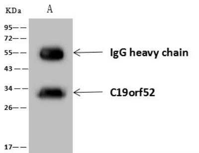 Immunoprecipitation TIMM29 Antibody - BSA Free