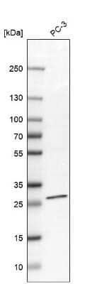 Western Blot: TIMM29 Antibody [NBP1-94151] - Analysis in human cell line PC-3.