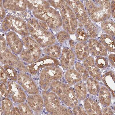 Immunohistochemistry-Paraffin TIMM8B Antibody - BSA Free