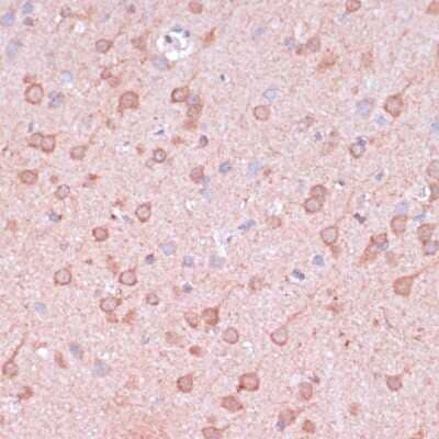 Immunohistochemistry-Paraffin: TIMM8B Antibody [NBP2-94190] - Rat brain using TIMM8B antibody at dilution of 1:100 (40x lens).