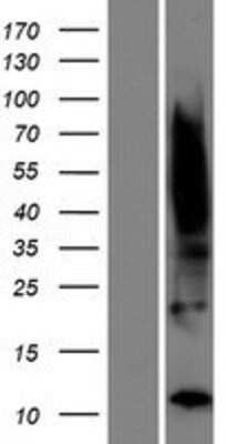 Western Blot TIMM8B Overexpression Lysate