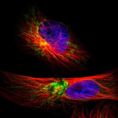 Immunocytochemistry/Immunofluorescence: TIMM9 Antibody [NBP1-80679] - Immunofluorescent staining of human cell line U-251 MG shows localization to mitochondria.
