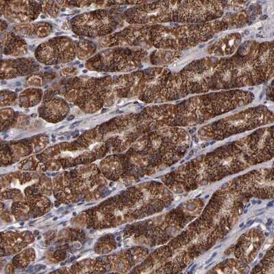 Immunohistochemistry-Paraffin: TIMM9 Antibody [NBP1-80679] - Staining of human stomach shows strong cytoplasmic positivity in glandular cells.