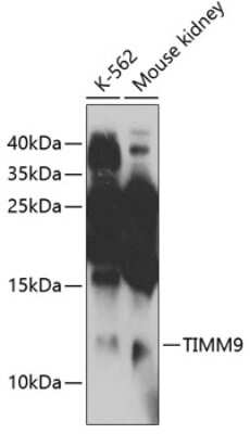 Western Blot: TIMM9 Antibody [NBP3-04808] - Analysis of extracts of various cell lines, using TIMM9 antibody at 1:1000 dilution. Secondary antibody: HRP Goat Anti-Rabbit IgG (H+L) at 1:10000 dilution. Lysates/proteins: 25ug per lane. Blocking buffer: 3% nonfat dry milk in TBST. Detection: ECL Enhanced Kit