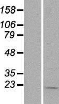 Western Blot: TIMM9 Overexpression Lysate (Adult Normal) [NBP2-07442] Left-Empty vector transfected control cell lysate (HEK293 cell lysate); Right -Over-expression Lysate for TIMM9.