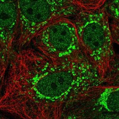 Immunocytochemistry/ Immunofluorescence TIMMDC1 Antibody - BSA Free
