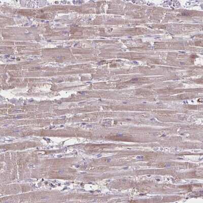 Immunohistochemistry TIMMDC1 Antibody - BSA Free