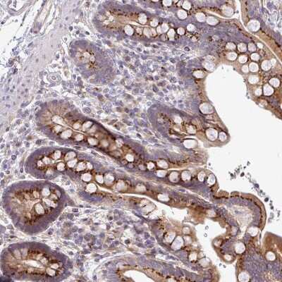 Immunohistochemistry-Paraffin TIMMDC1 Antibody - BSA Free