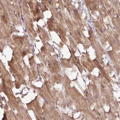 Immunohistochemistry-Paraffin TIMMDC1 Antibody - BSA Free