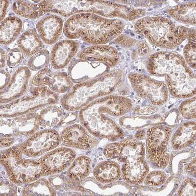 Immunohistochemistry-Paraffin: TIMMDC1 Antibody [NBP2-13433] - Staining of human kidney shows moderate granular cytoplasmic positivity in cells in tubules.