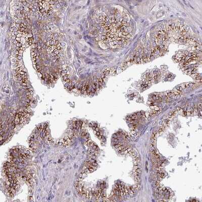 Immunohistochemistry-Paraffin: TIMMDC1 Antibody [NBP2-13433] - Staining of human prostate shows strong granular cytoplasmic positivity in glandular cells.