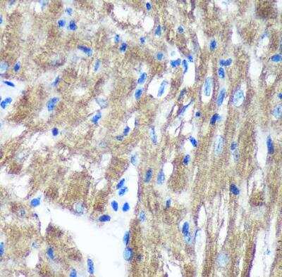 Immunohistochemistry-Paraffin TIMMDC1 Antibody - Azide and BSA Free