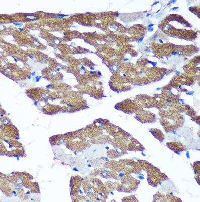 Immunohistochemistry-Paraffin TIMMDC1 Antibody - Azide and BSA Free