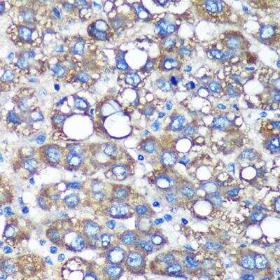 Immunohistochemistry-Paraffin TIMMDC1 Antibody - Azide and BSA Free