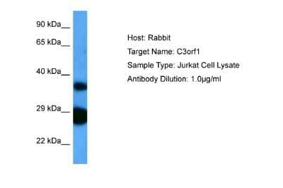 Western Blot: TIMMDC1 Antibody [NBP2-85919] - Host: Rabbit. Target Name: C3ORF1. Sample Tissue: Human Jurkat Whole Cell lysates. Antibody Dilution: 1ug/ml
