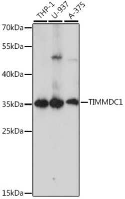 Western Blot TIMMDC1 Antibody - Azide and BSA Free