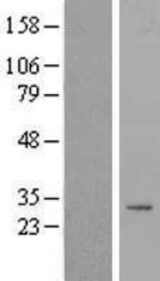 Western Blot TIMMDC1 Overexpression Lysate