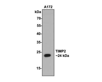 Western Blot: TIMP-2 Antibody (JM87-10) [NBP2-67204] - Analysis of TIMP-2 on A172 cell lysates with Rabbit anti-TIMP-2 antibody at 1/500 dilution. Lysates/proteins at 10 ug/Lane. Predicted band size: 24 kDa Observed band size: 24 kDa Exposure time: 2 minutes; 12% SDS-PAGE gel. Proteins were transferred to a PVDF membrane and blocked with 5% NFDM/TBST for 1 hour at room temperature. The primary antibody at 1/500 dilution was used in 5% NFDM/TBST at room temperature for 2 hours. Goat Anti-Rabbit IgG - HRP Secondary Antibody at 1:200,000 dilution was used for 1 hour at room temperature.
