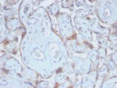 Immunohistochemistry-Paraffin: TIMP-2 Antibody (TIMP2/2488R) - Azide and BSA Free [NBP3-08721] - Formalin-fixed, paraffin-embedded human Placenta stained with TIMP-2 Rabbit Recombinant Monoclonal Antibody (TIMP-2/2488R).
