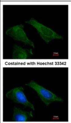 Immunocytochemistry/Immunofluorescence: TIMP-4 Antibody [NBP2-20645] - Analysis of methanol-fixed HeLa, using antibody at 1:200 dilution.