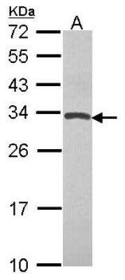 Western Blot: TIMP-4 Antibody [NBP2-20645] -  Sample (30 ug of whole cell lysate) A: Hela 12% SDS PAGE gel, diluted at 1:1000.